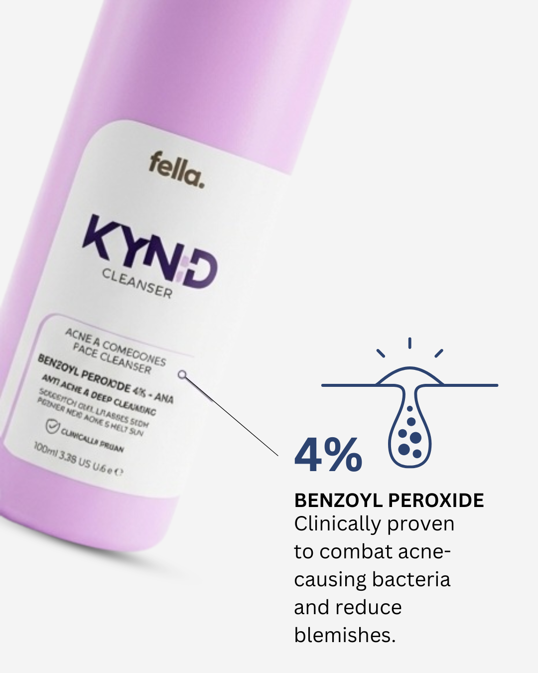 KYND - BENZOYL PEROXIDE 4% - AHA Acne & Comedones Cleanser